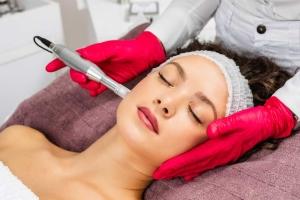 Skin Microneedling melbourn - Skin Microneedling armadale - Skin Microneedling australia