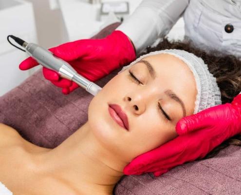 Skin Microneedling melbourn - Skin Microneedling armadale - Skin Microneedling australia