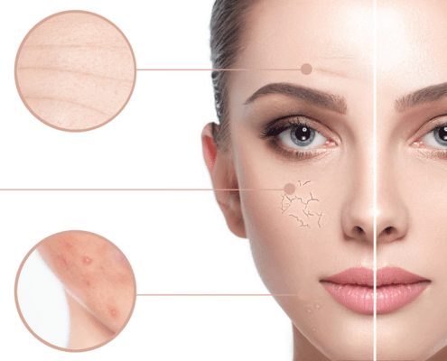 Skin Rejuvenation Melbourne