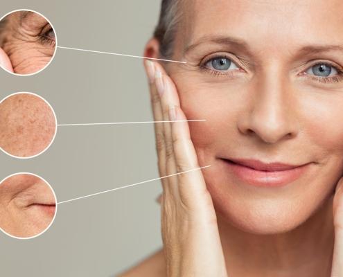 Skin Aging Melbourne, Skin Aging donvale, Skin Aging doncaster